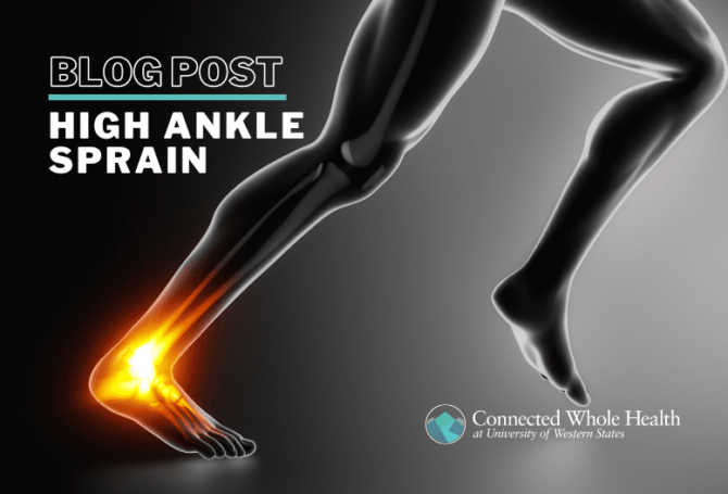 Image for High Ankle Sprain