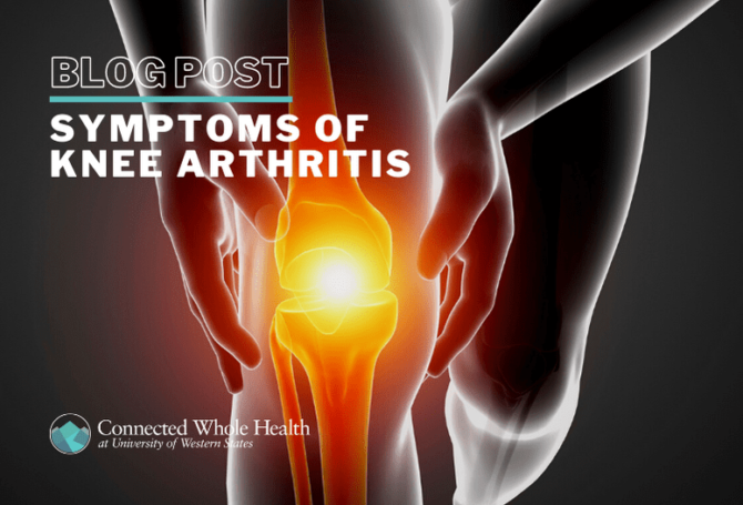 Image for Symptoms Of Knee Arthritis