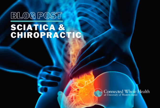 Image for Sciatica & Chiropractic