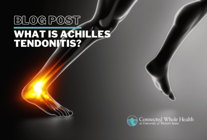 Image for What is Achilles Tendonitis?